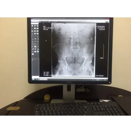 5aac332662b9d_Xrayforwebsite.jpg